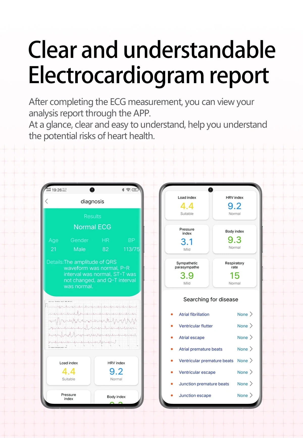 New ECG+PPG Nursing Grade Air Bag Smart Watch Men's Blood Fat Blood Pressure Voice Broadcast Health Smart Bracelet For Woman NFC