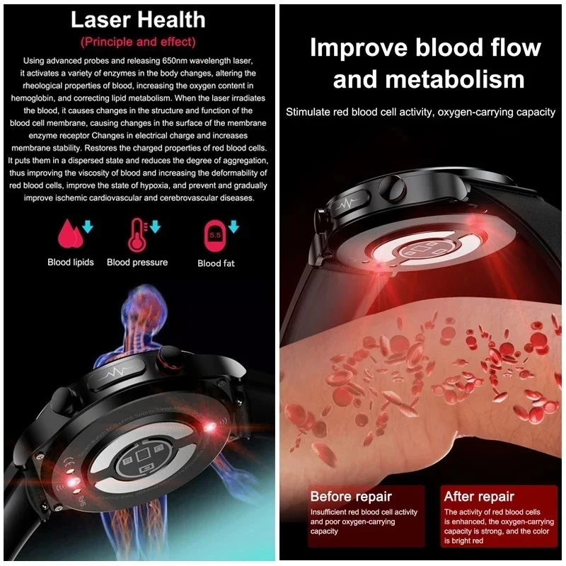 2026New Precise Laser Therapy Bracelet Health ECG+PPG Smart Watch Blood Pressure Blood Lipid Uric Acid BT HD Call SmartWatch Men