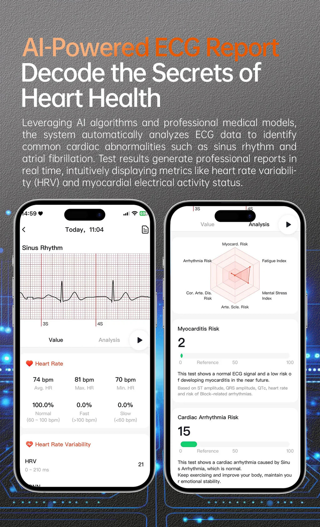 2025New Health Monitoring Uric Acid Blood Pressure Blood oxygen Body Analysis Smart Watch ECG+PPG Clock Smartwatches Men For IOS