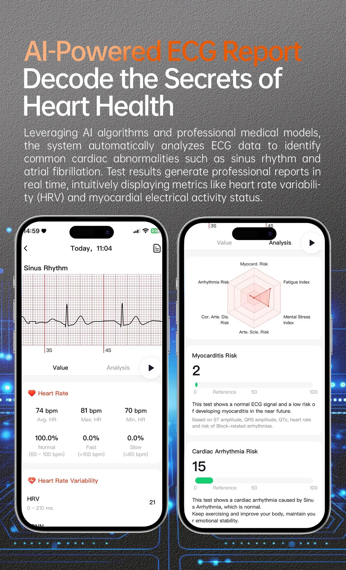 2025New Health Monitoring Uric Acid Blood Pressure Blood oxygen Body Analysis Smart Watch ECG+PPG Clock Smartwatches Men For IOS